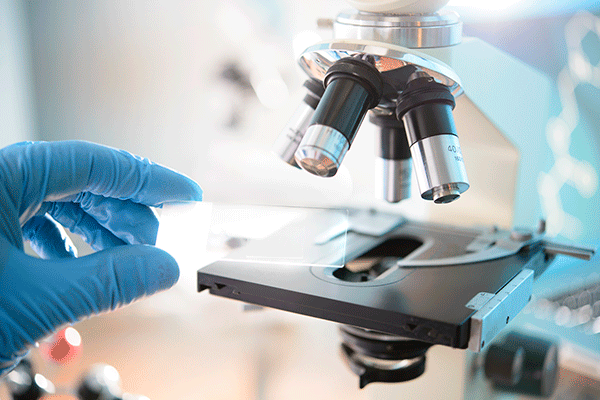 Detailed image of a hand wearing a blue surgical glove placing a glass plate onto the platform of a microscope. 